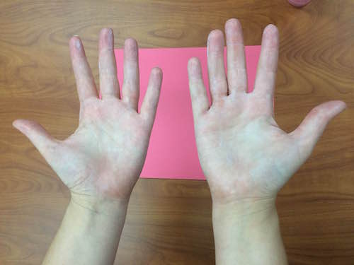 palms of hands turned upward showing a thin layer of sunscreen